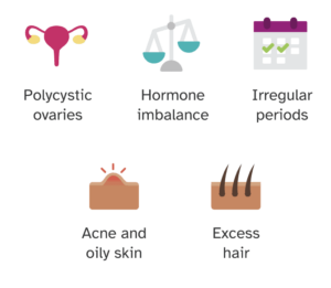 Common symptoms of PCOS include polycystic ovaries (more ovarian follicles), hormone imbalance, irregular periods, acne and oily skin, and excess hair