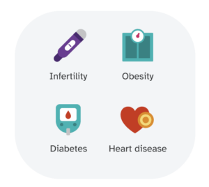 PCOS risk factors include infertility, obesity, diabetes, and heart disease