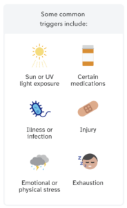 Infographic showing some common triggers for lupus flares can include sun or UV light exposure, certain medications, illness or infection, injury, emotional or physical stress, or exhaustion